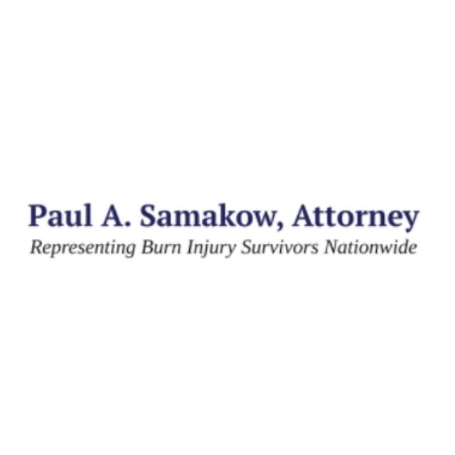 National Burn Attorney