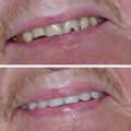 Burton Denture Clinic
